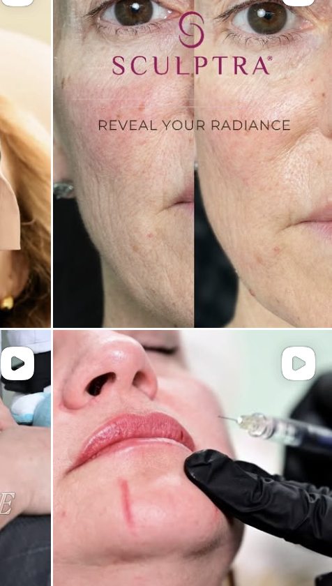 Aplicacion estetica facial